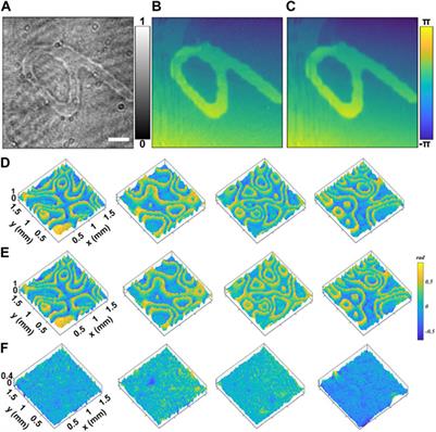 Deep learning-based quantitative phase microscopy